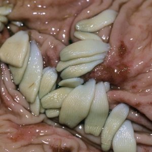 bandwurm