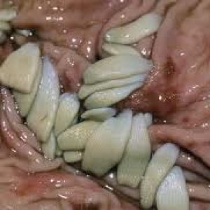 bandwurm